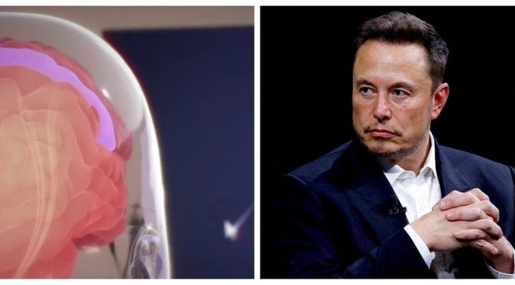 Elon Musk said that a person with a chip in his head can already control a computer mouse with the power of thought